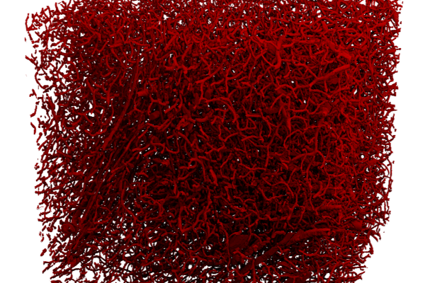 reconstructed microvessels